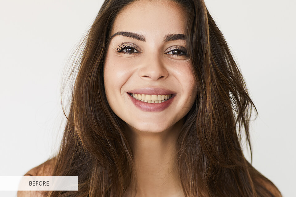 teeth whitening lightroom brush