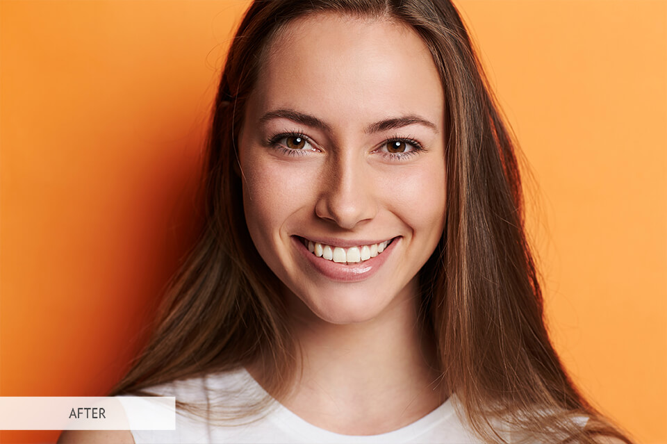 teeth whitening lightroom brush