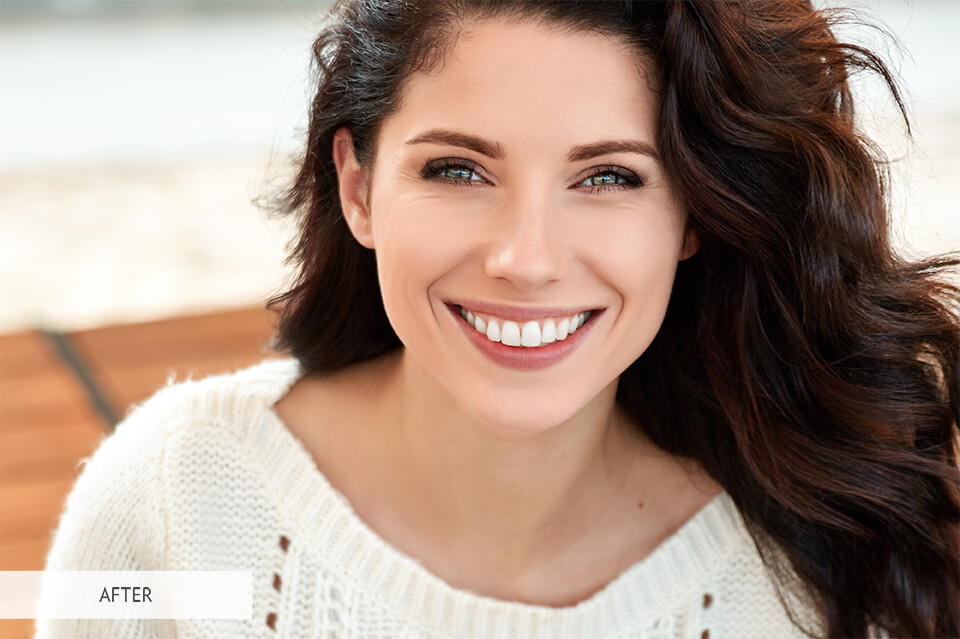teeth whitening lightroom brush