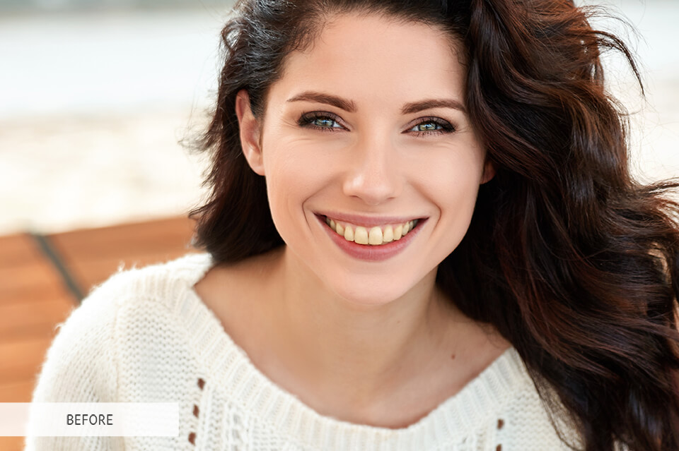 teeth whitening lightroom brush