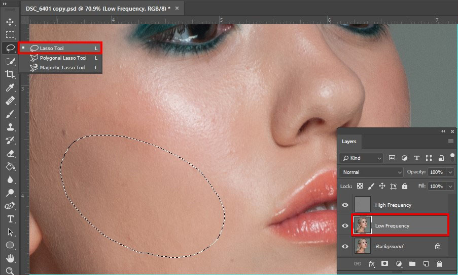 eliminate skin color irregularities