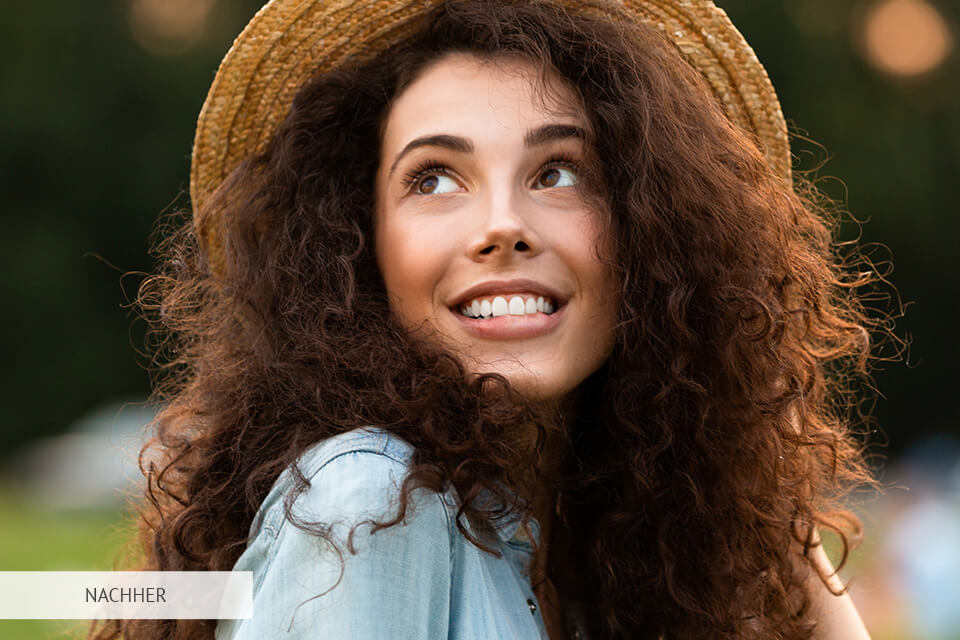 zahnaufhellung aktion vorher und nachher