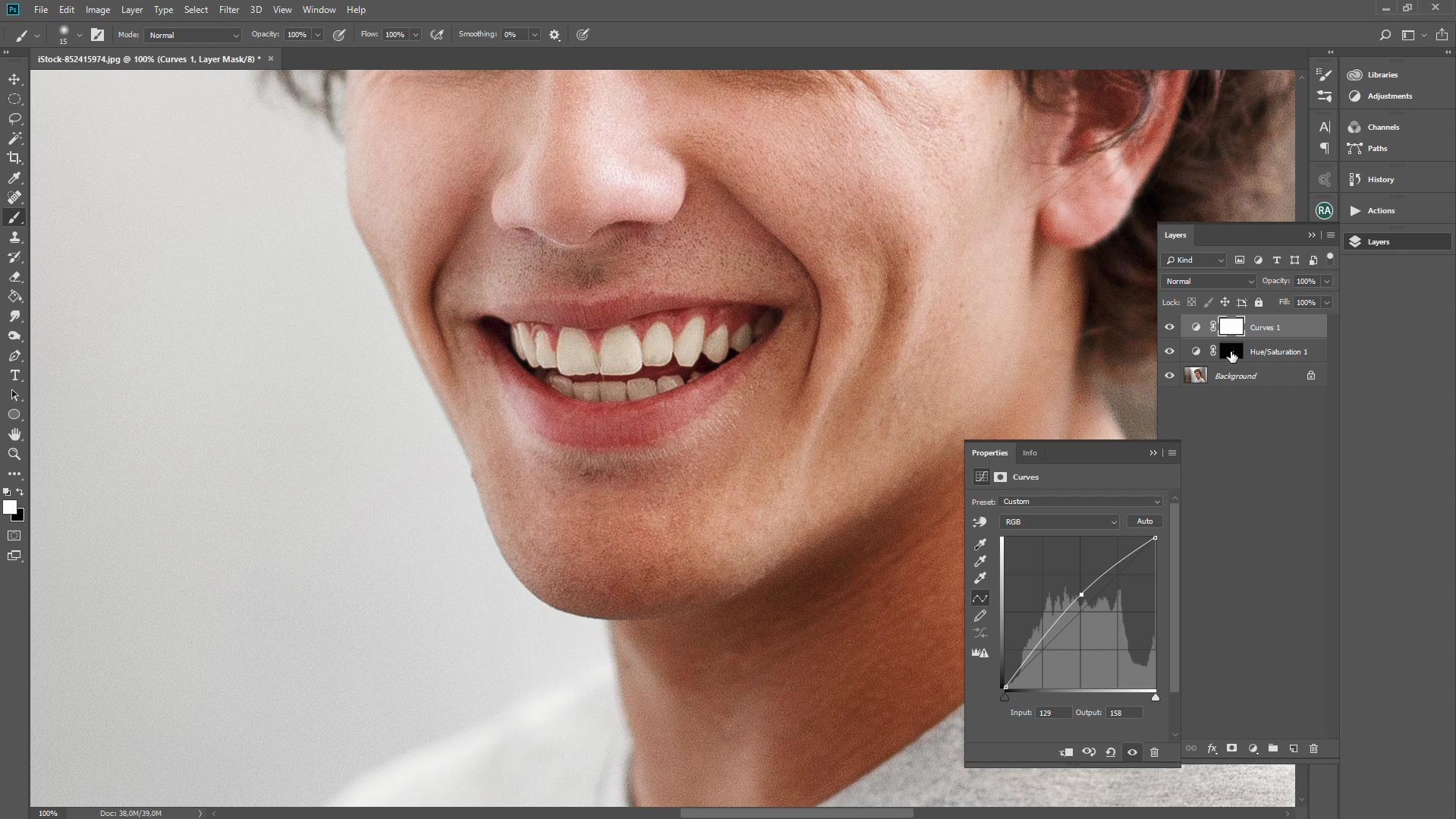 # Laser Teeth Whitening Raleigh - Whiten # Laser Teeth Whitening Raleigh - Whiten