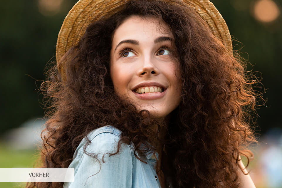 zahnaufhellung aktion vorher und nachher