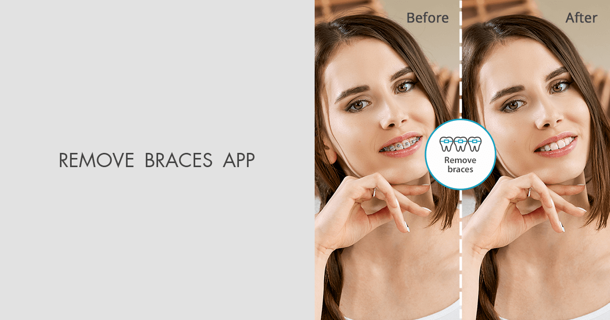 Remove Braces App for Android and iOS