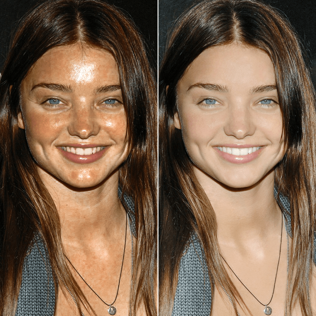 Celebrity Photo Fails Before And After Photos Infoupdate